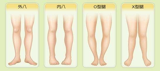 pg电子赏金试玩app 孩子是O型腿X型腿怎么办？不慌，这些阶段腿型“不正常”才正常