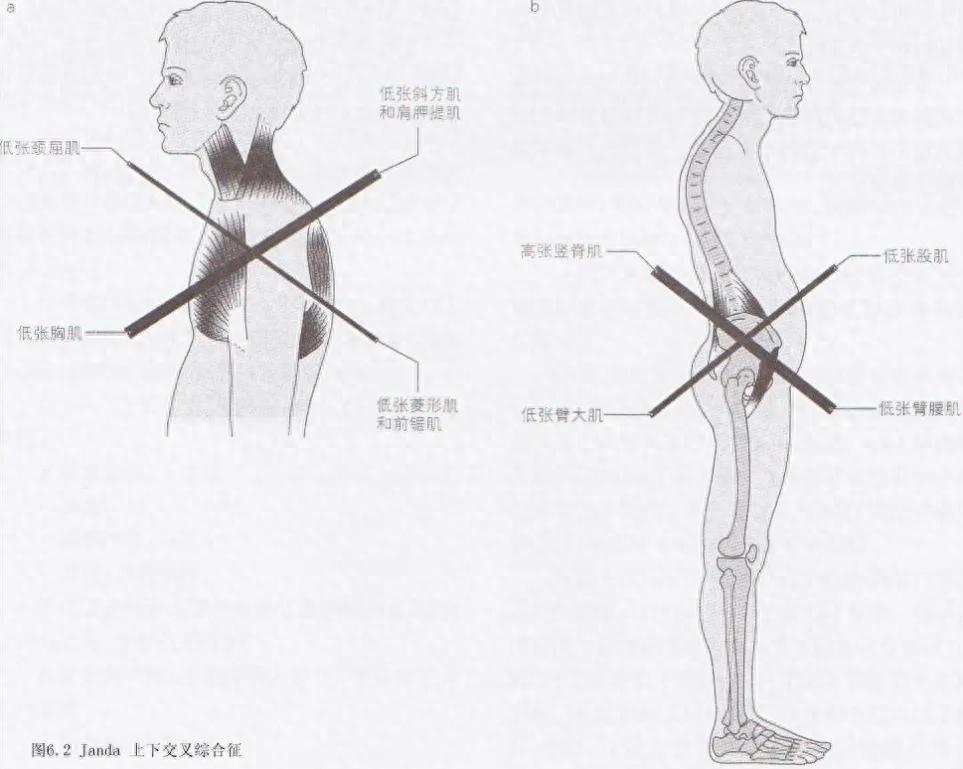 pg娱乐电子游戏 每天10分钟靠墙站 帮你缓解肩颈痛、改善体态