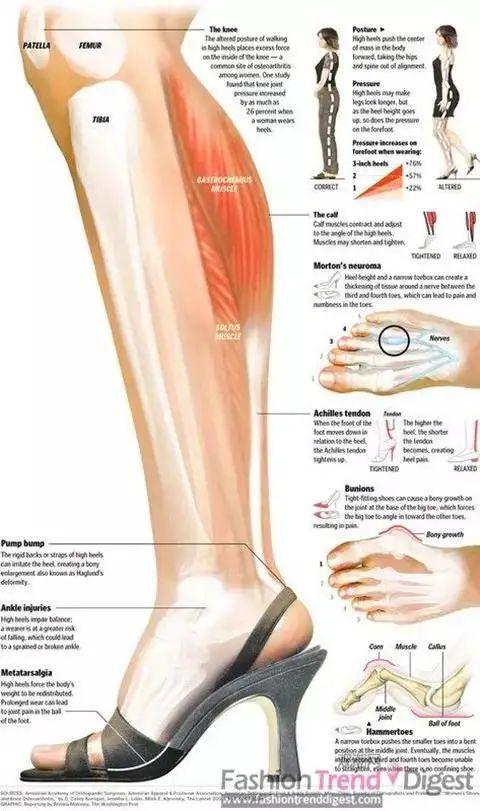 瘦腿操练视频_瘦小腿不同类型针对性训练_判断肌肉腿脂肪腿水肿腿