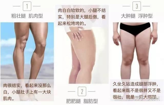 脂肪腿训练_瘦腿操下载_肌肉腿矫正
