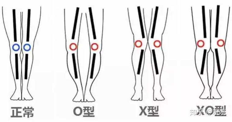 肌肉腿矫正_瘦腿操下载_脂肪腿训练