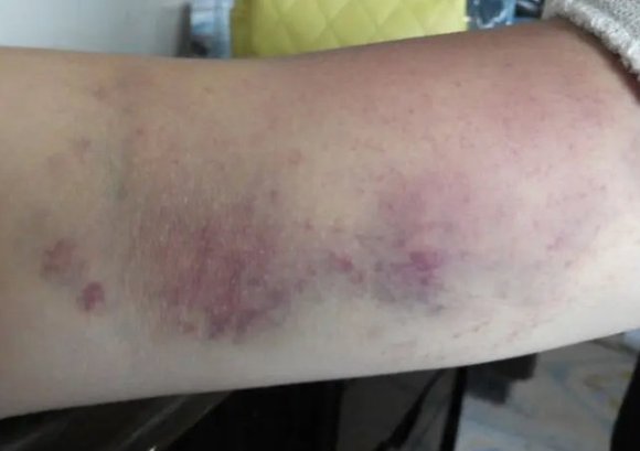 筋膜枪有害吗_综合训练器怎么样贴吧_筋膜枪四大禁忌