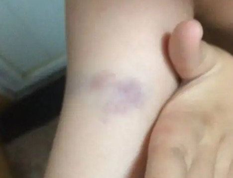 筋膜枪选购避雷指南_筋膜枪是智商税吗_综合训练器怎么样贴吧