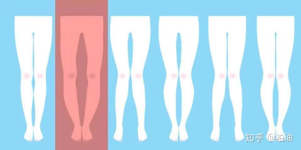 腿向后踢屁股有什坏处_X型腿O型腿区别_腿型分析